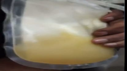 Fake platelets case beli used to play with fake slips of SRN Hospital and AMA