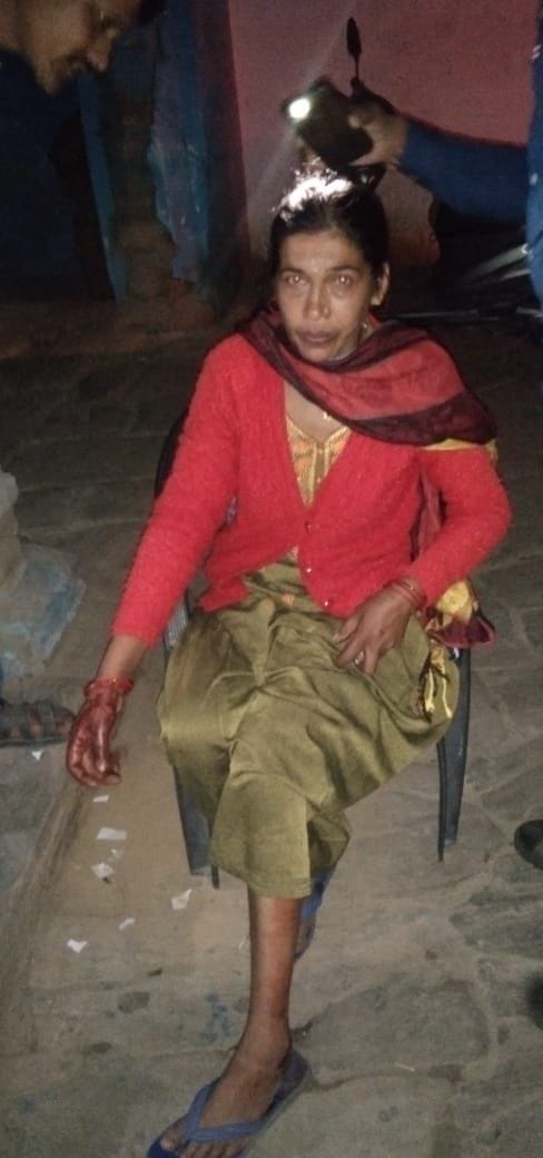 Women Injured In Lepoard Attack