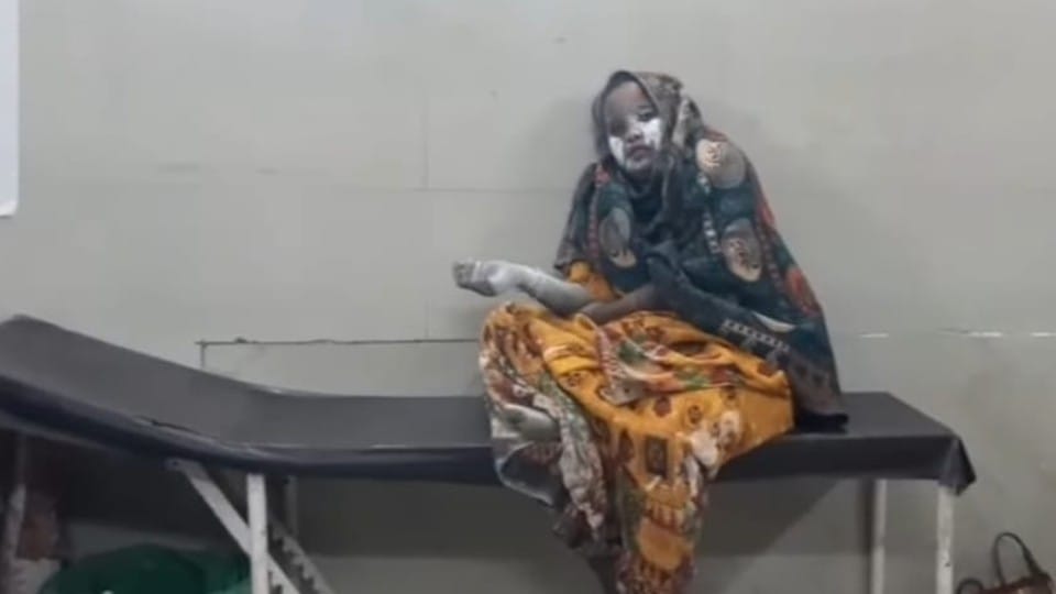 Damoh: Lime tank explodes in Damoh, mother and son scorched with loud bang