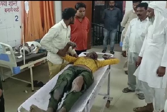 Hathras: Explosion while grinding by mixing sulfur-potash, youth scorched