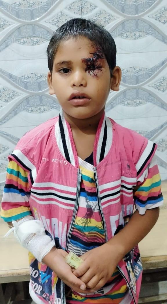 Stray dog bites two including child