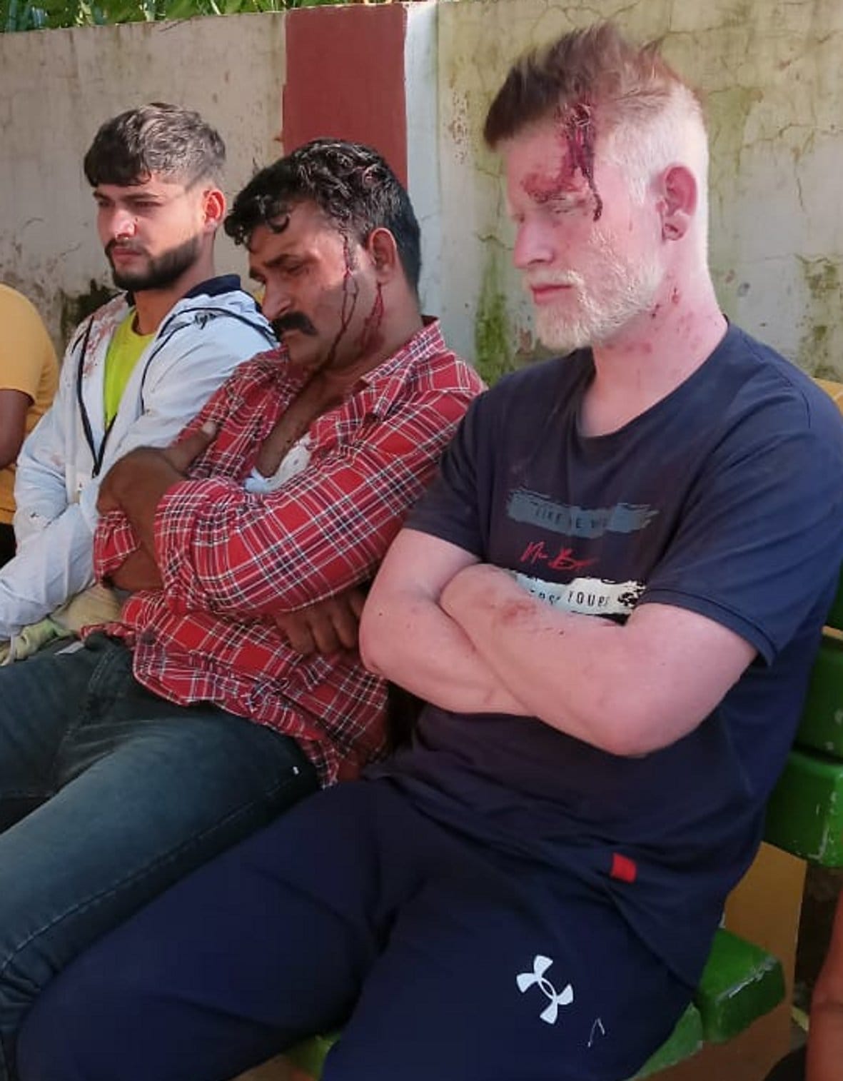 Quarrel between two sides, allegations of stone pelting and firing in front of police