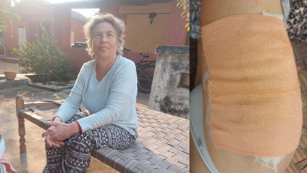 Terror of stray animals in Orchha Cow tossed foreign tourist into the air with horns had to apply 25 stitches