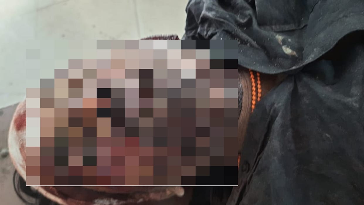 young man beaten to death, not identified even after 24 hours in korba