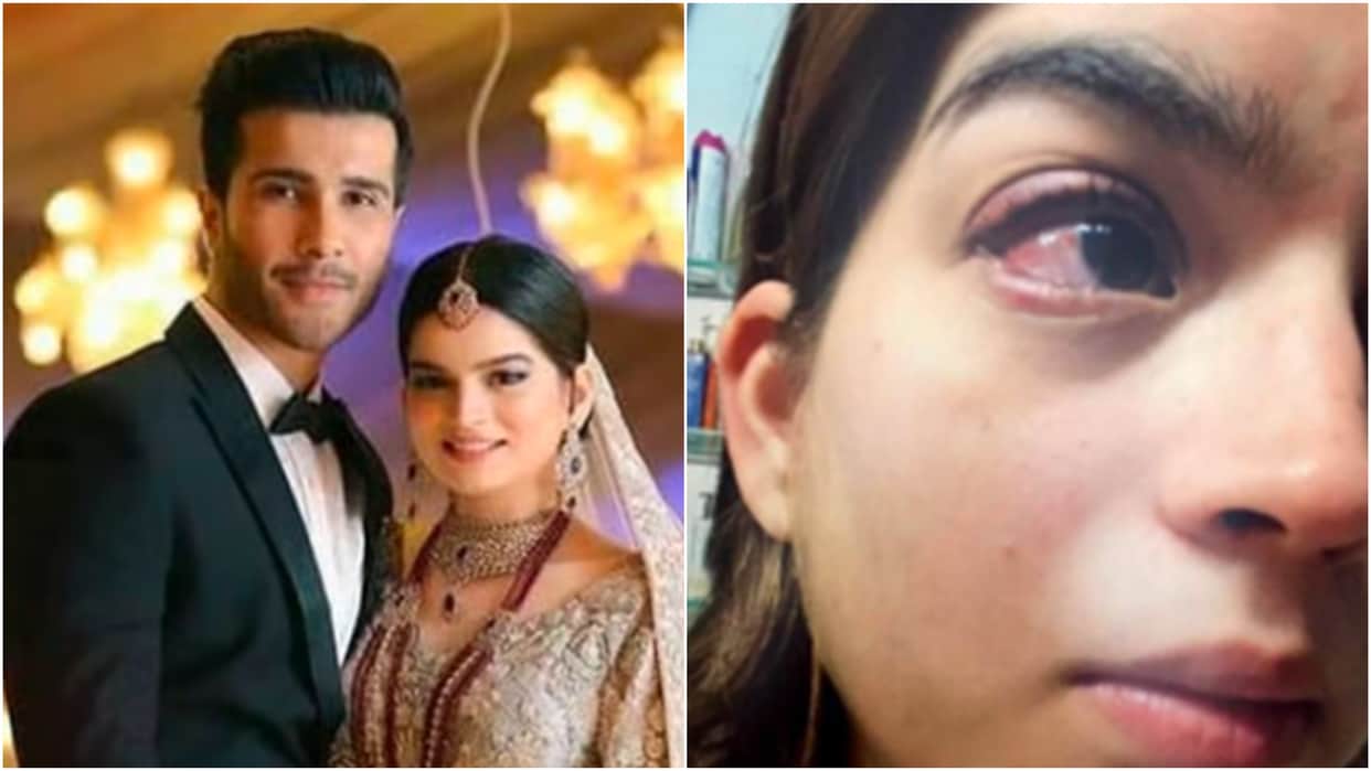 pakistani actor feroze khan wife syeda aliza shares domestic violence evidence on social media
