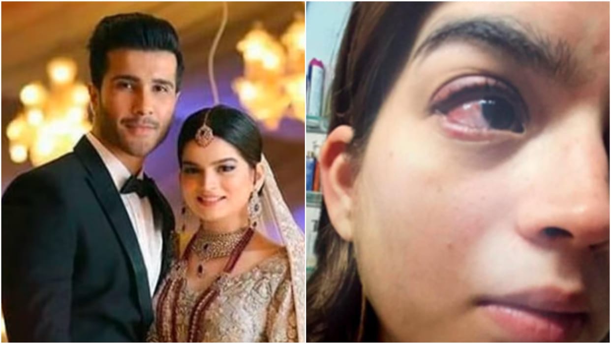 pakistani actor feroze khan wife syeda aliza shares domestic violence evidence on social media