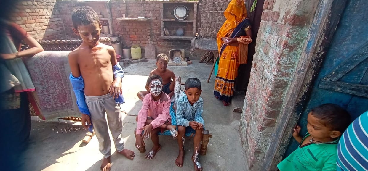 Hathras: Five teenagers were badly burnt while setting off fireworks