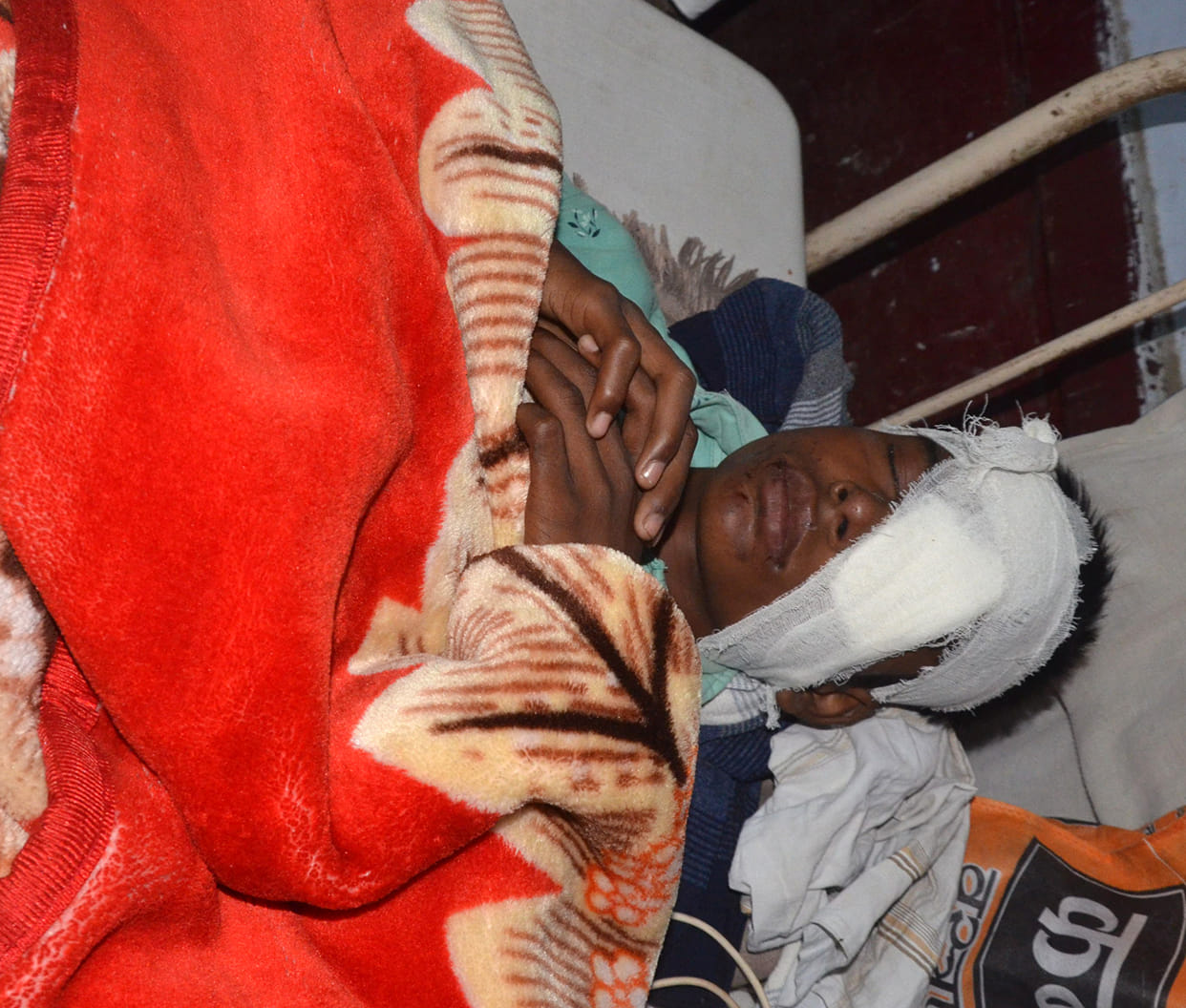 Eyes injured due to firecrackers, many hands also got burnt