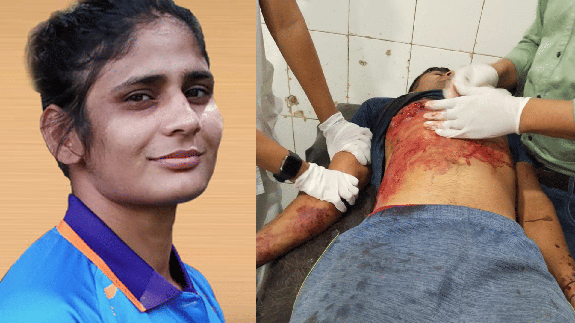 Gwalior News: Brother Of International Wrestler Rani Rana Attacked, Hospitalised