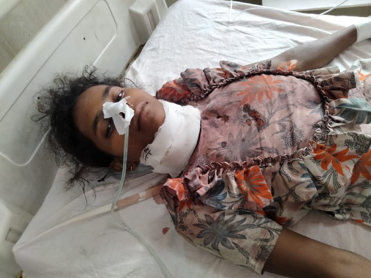 Brother attacked sister with sickle, serious