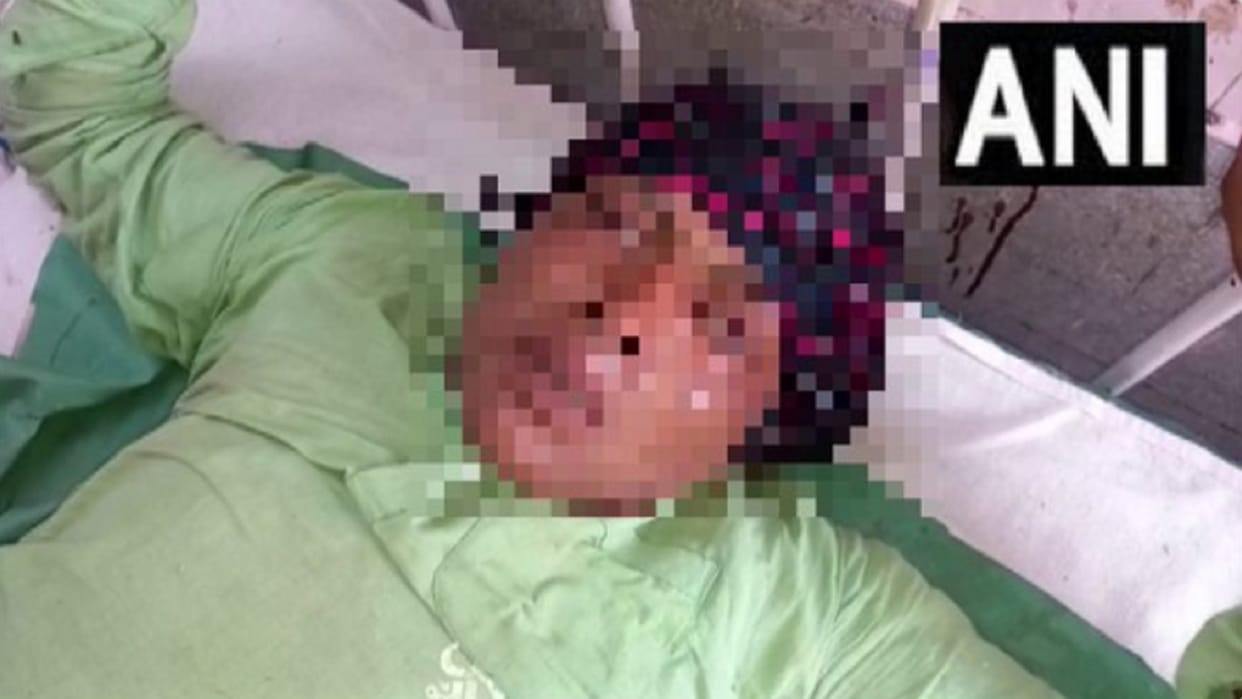 sedated the young man's limb