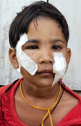 Injured girl dies due to jackal bite in Simri