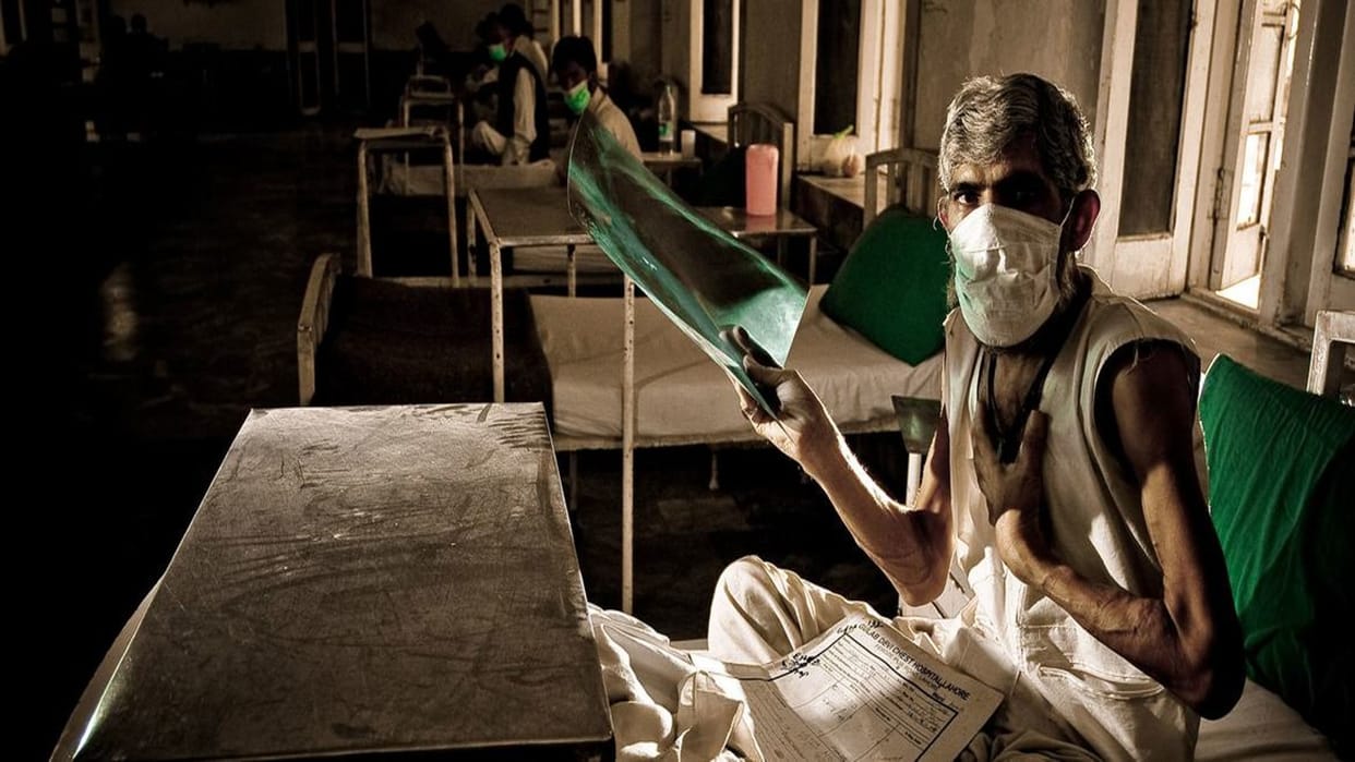 Deaths because of TB also increased during the Covid epidemic, reveals WHO report