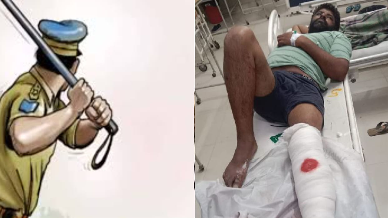 Police hit the youth with a stick at Sirsi booth in Bhiwani, broken leg bone
