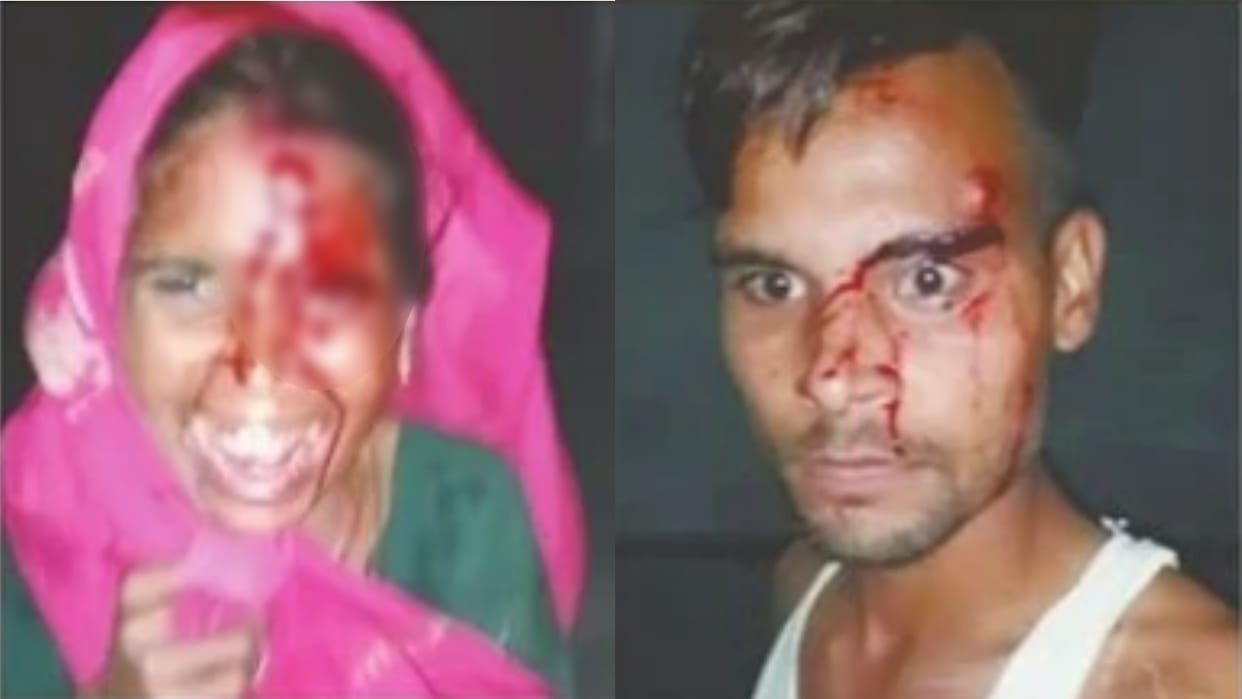 police beat accused family during raid