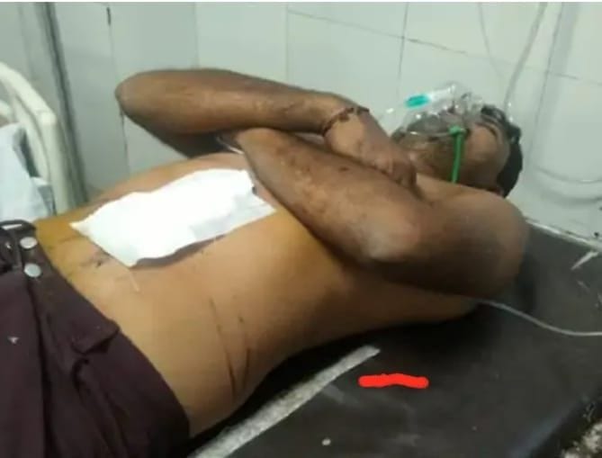 Robbers shot truck driver, condition critical