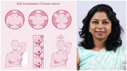Know which women must get breast cancer screening