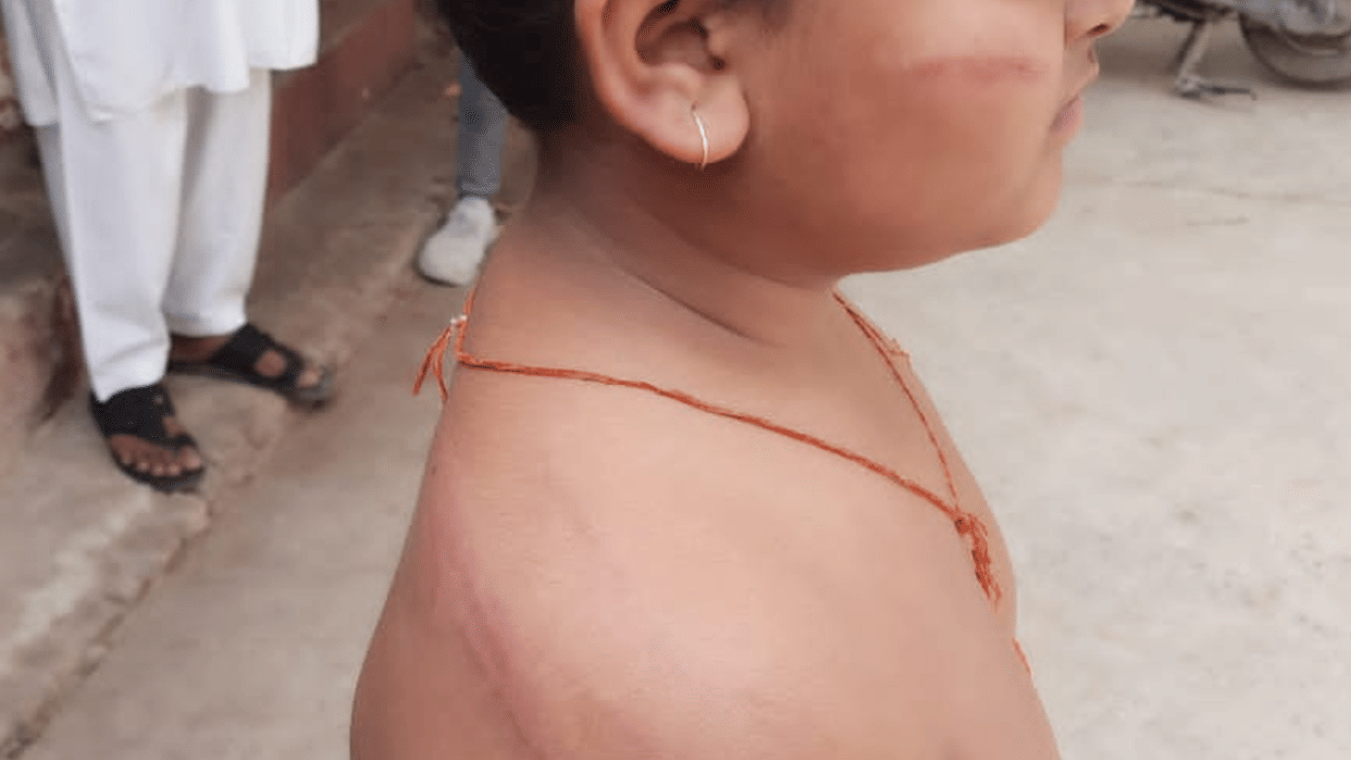 Gwalior News: Student of Class I Beaten Up With A Stick For Misspelling a Word, FIR Registered