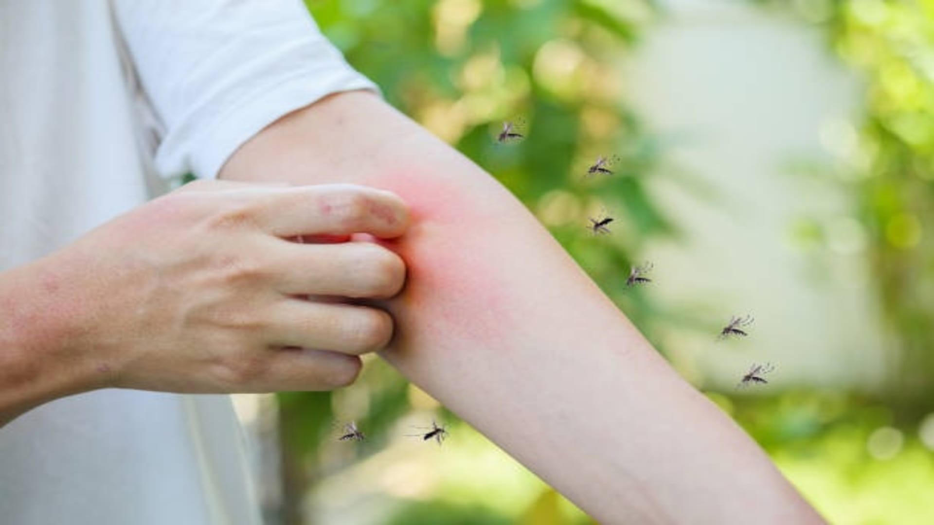 Why do mosquitos bite some people more than others, know the reason behind it