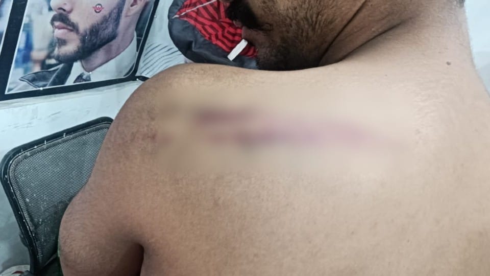 Barber released video accusing PAC constables of beating in Agra