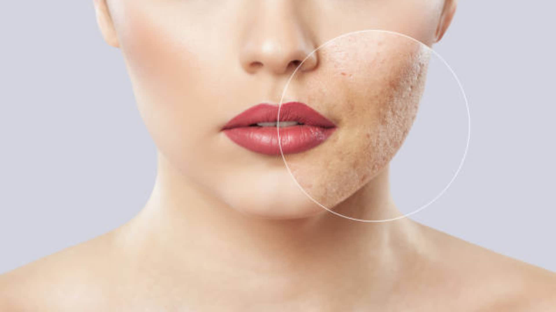 cucumber face pack for remove facial marks and acne scars