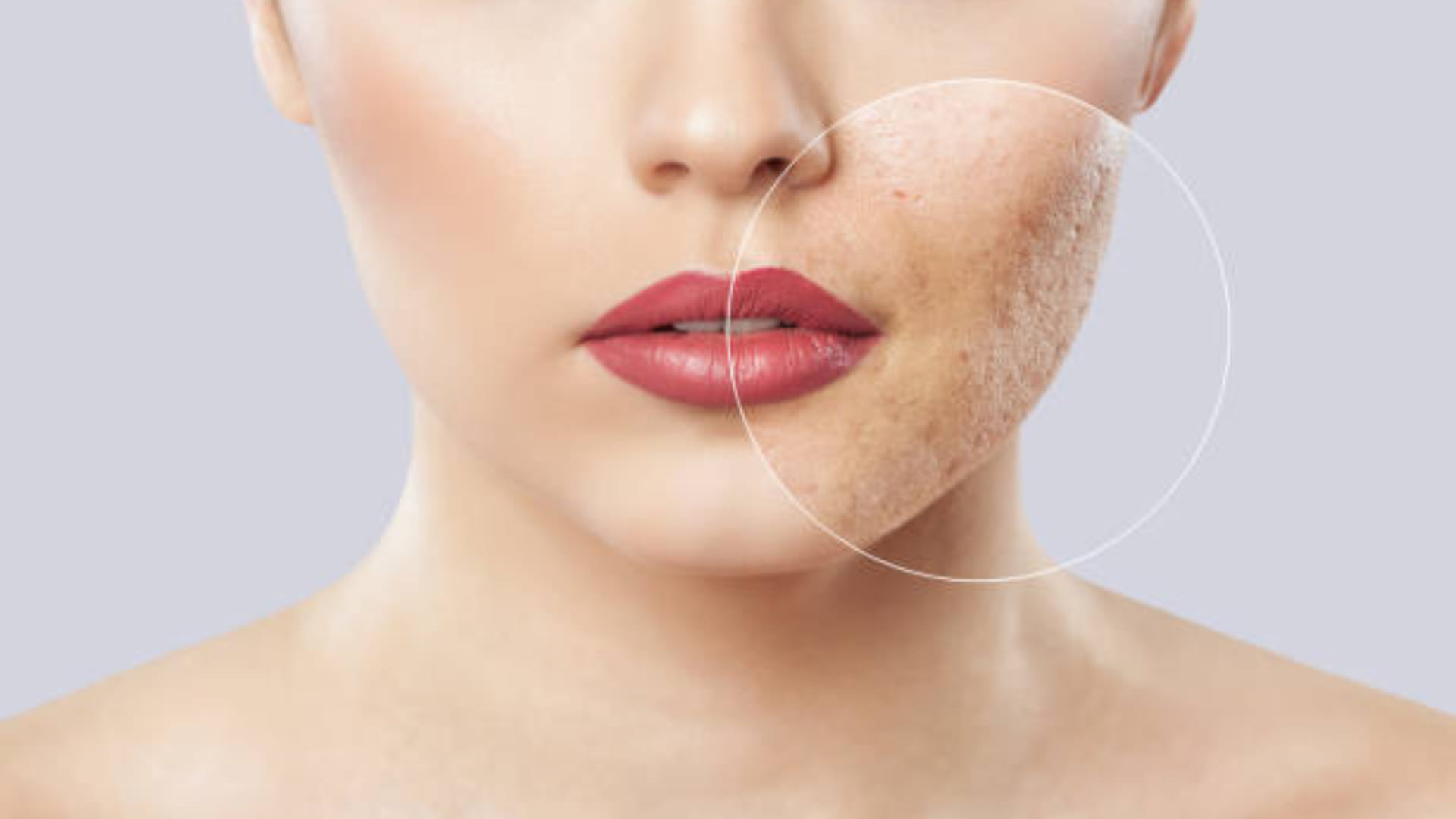 cucumber face pack for remove facial marks and acne scars