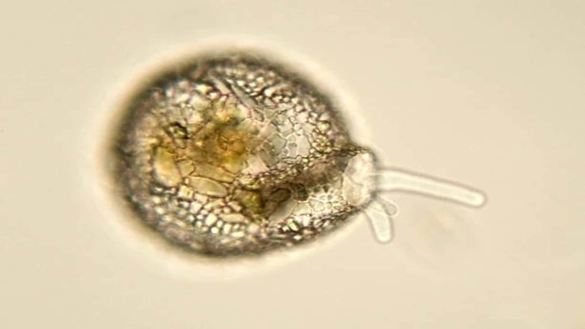 Brain Eating Amoeba Cause Death of 97 Percent Patient Research News in Hindi