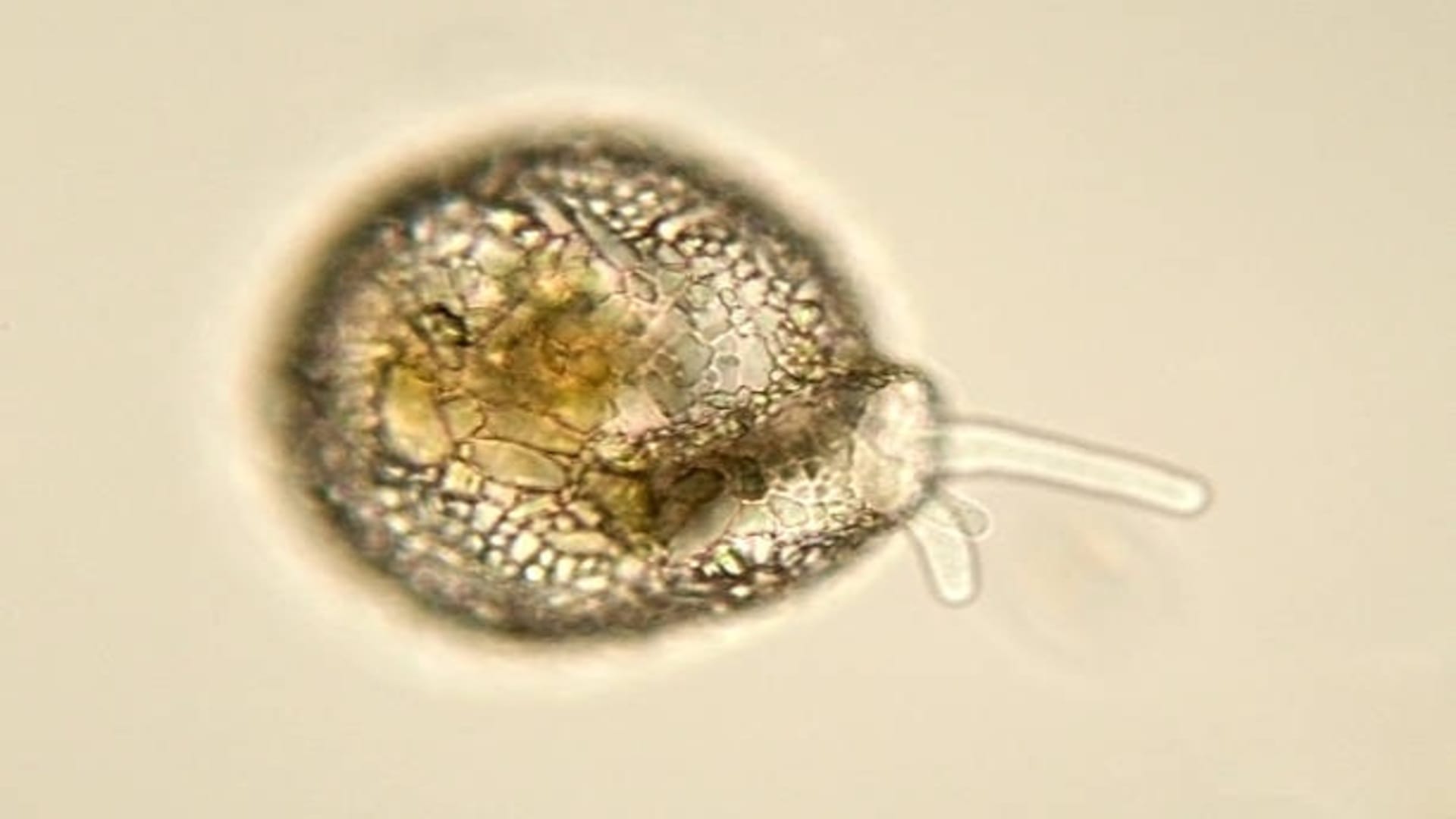 Brain Eating Amoeba Cause Death of 97 Percent Patient Research News in Hindi