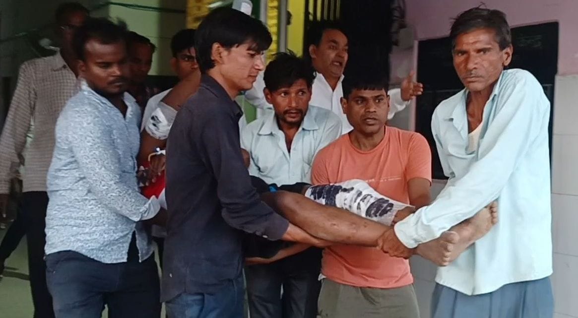 Kanpur Dehat : Stretcher not found in Sikandra CHC, patient picked up by hand