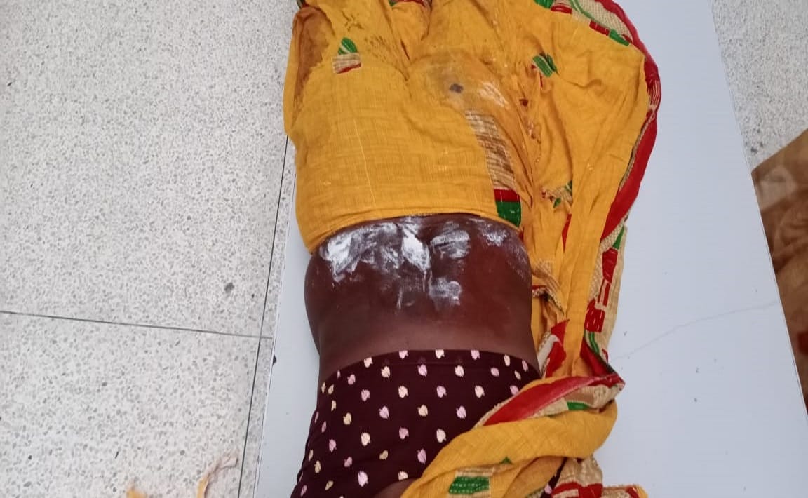 Woman scorched due to fire in saree  Kashi for Kartik Purnima bath from Nepal