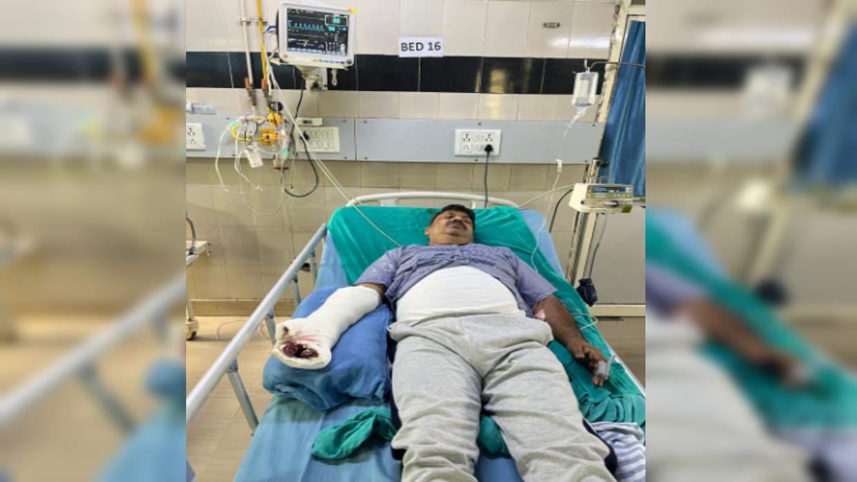 Bijnor Najibabad Kotwal hand surgery lasted for four hours dog had chewed his arm