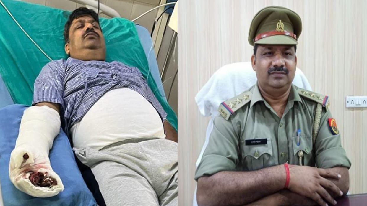 A dog attacked on inspector in Bijnor, got plastic surgery on hand in four hours