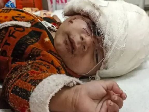 Siyar attacked an innocent six-month-old girl in kota