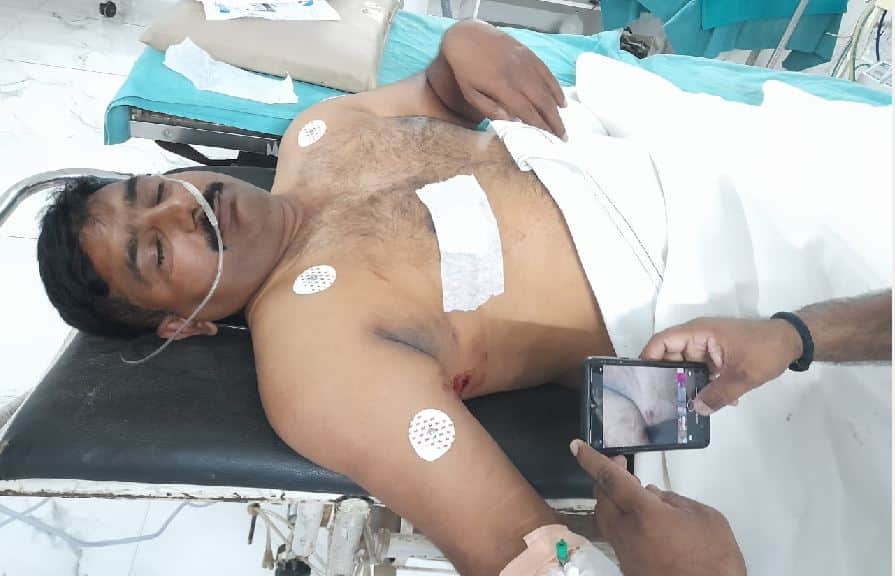 Challenge to Police in Varanasi criminal firing on chest of daroga saying that he became  goon