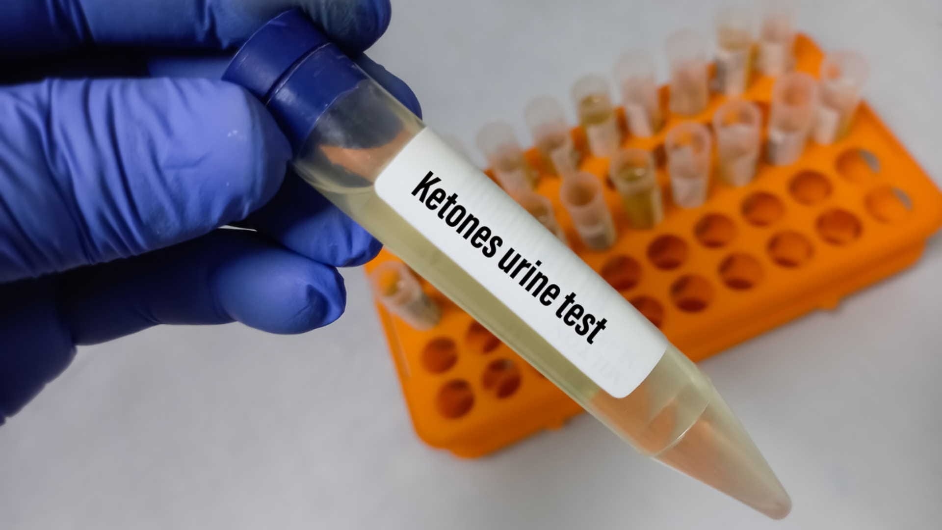 world diabetes day 2022, Know Diabetic Ketoacidosis Disease Symptoms Causes and Severity in Hindi