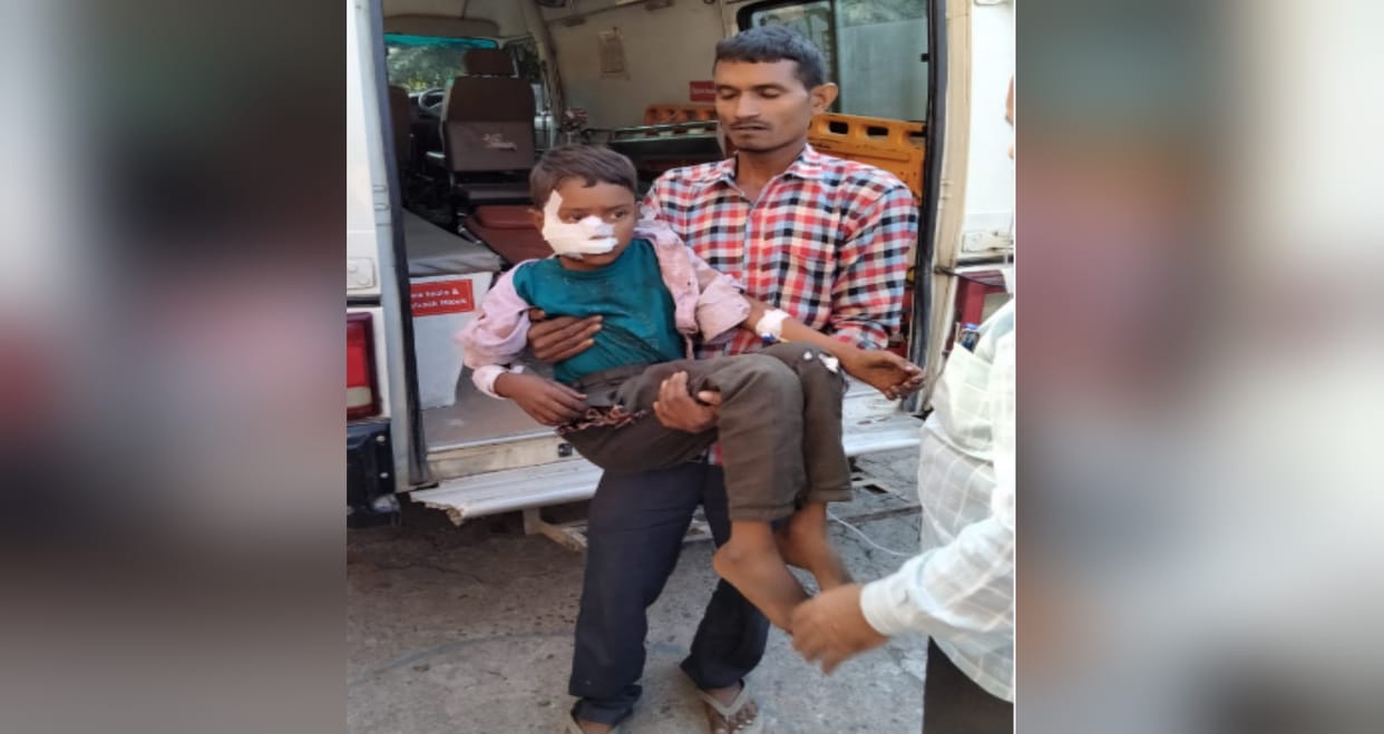 Guldar attack on child returning from farm with mother in Bijnor, injured