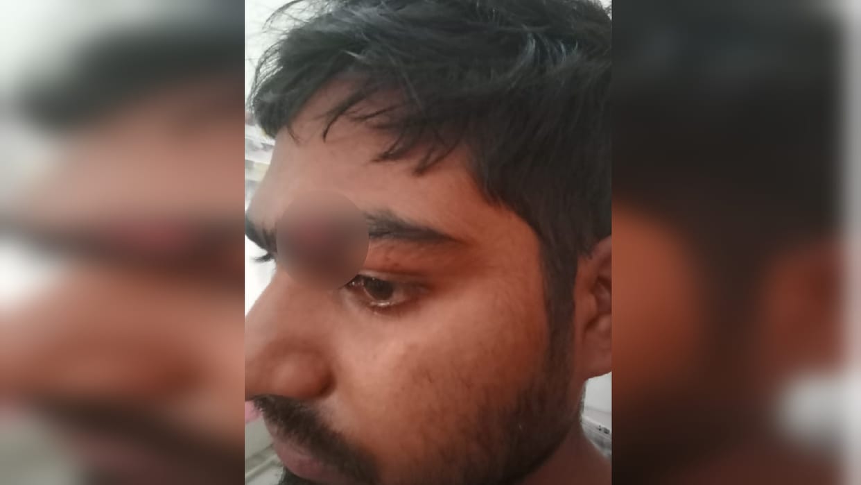 Pradhan husband and his brother attacked with knife four arrested