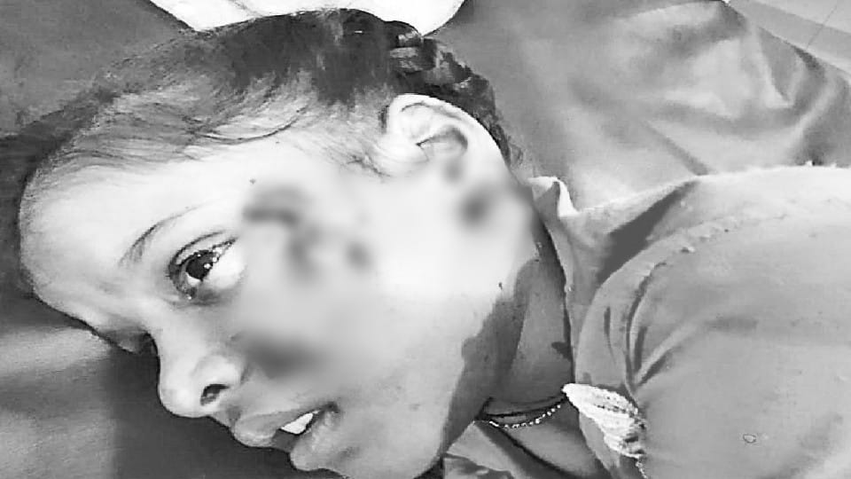German Shepherd dog attacked seven-year-old girl in firozabad