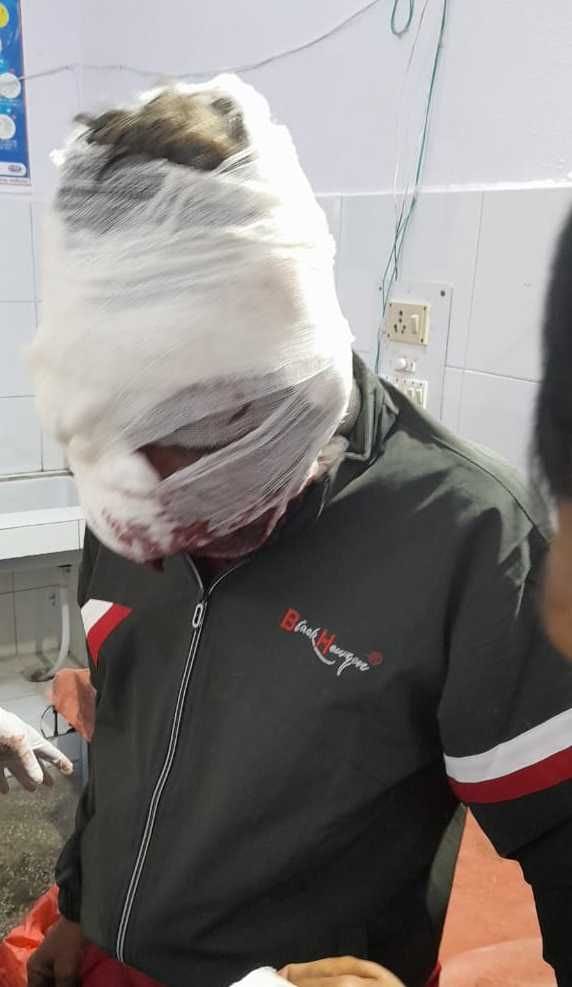 Man Attacked By Bear In Jubra Village