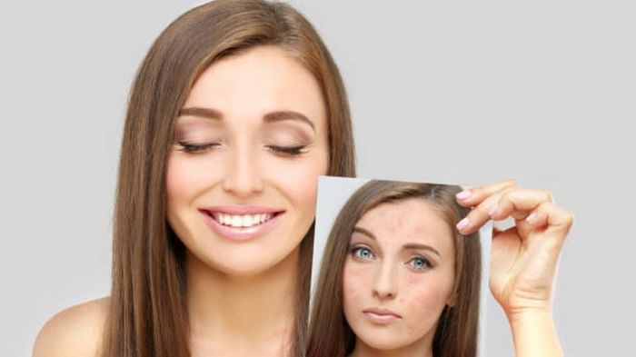 Skin care tips after threading in hindi do not do these thing afer threading