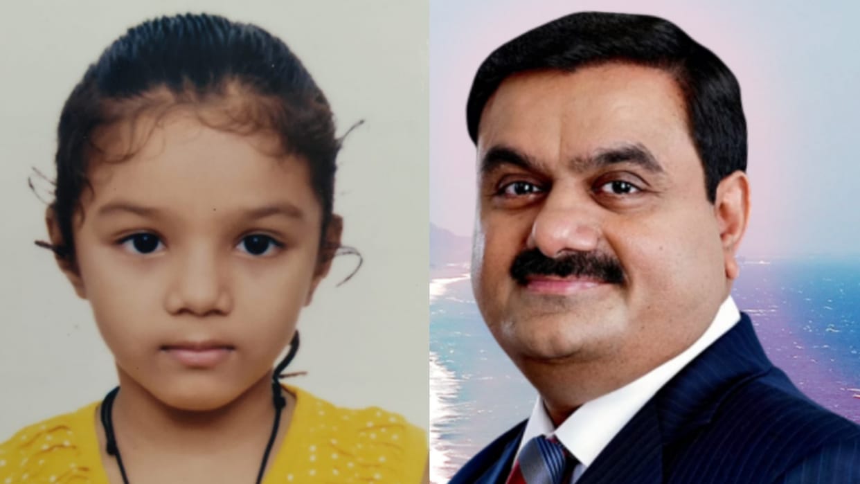 Gautam Adani will fund the treatment of a 4 years old girl of Lucknow.