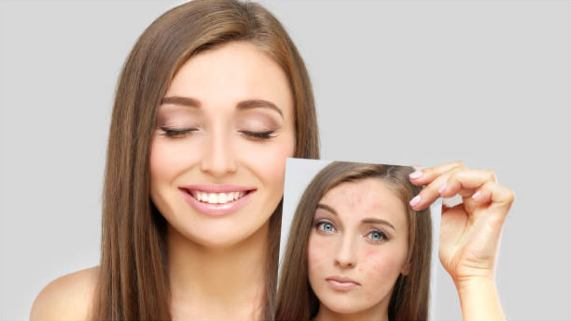 get fair and glowing skin with homemade bleach