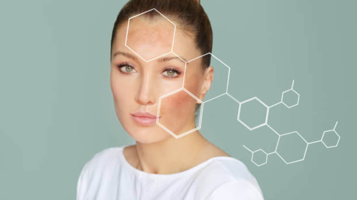 get fair and glowing skin with homemade bleach