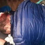 Nepal Election: CPN-UML leader Hari Kafle got injured in an attack