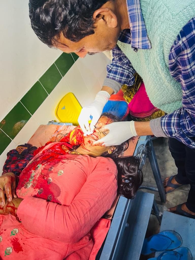 Woman injured in leopard attack in Betalghat