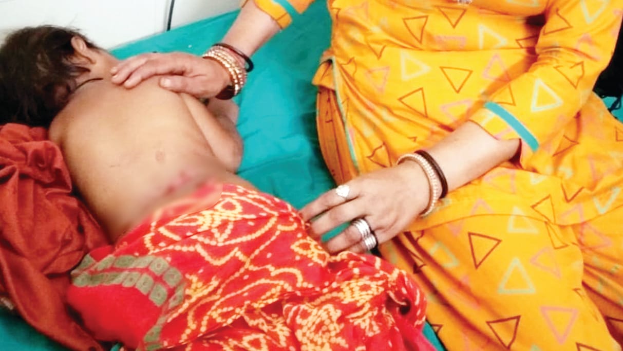 Jhajjar: Bulli breed dog attacked on a three-year-old girl
