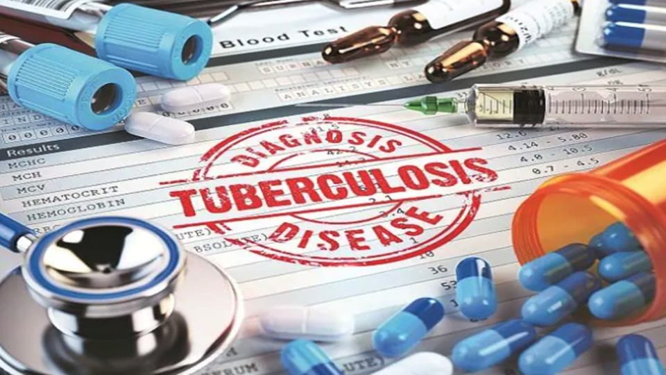 Tuberculosis cases on rise for first time in decades Expert