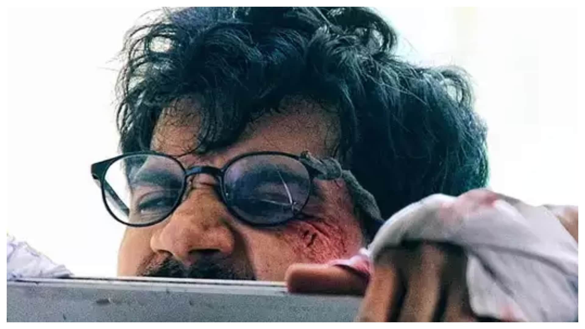 These Bollywood Stars Hurted Their Mentally Health for Roles From Deepika Chhapaak To Janhvi Kapoor Mili
