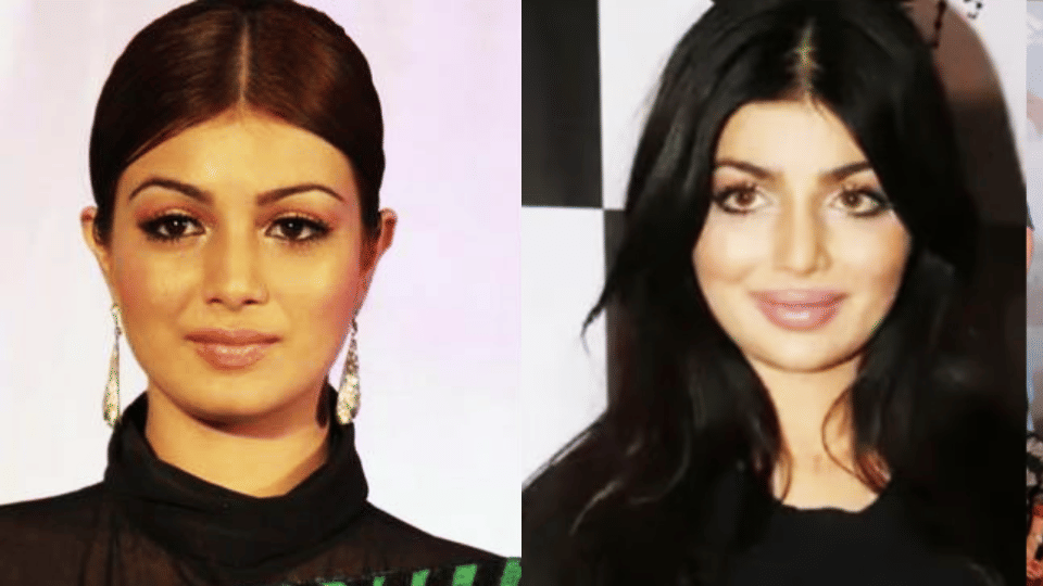bollywood actresses plastic surgery gone wrong Shruti Haasan Ayesha Takia Sara Khan