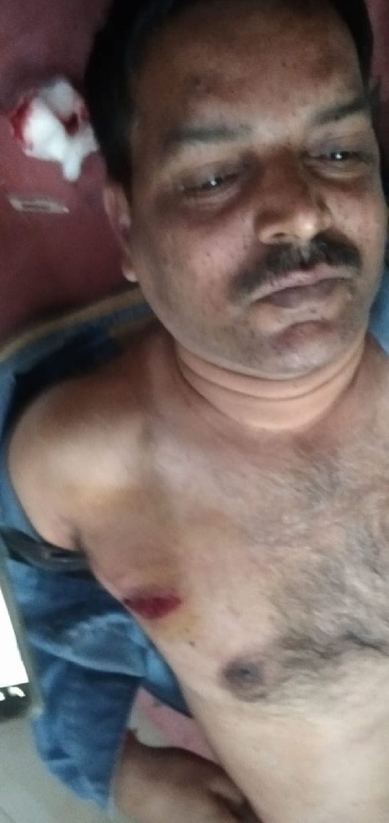 Lawyer shot for opposing theft